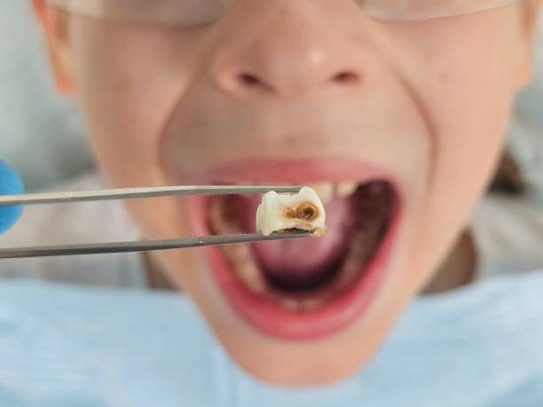 Best Weekend Emergency Dentist in Rector, AR